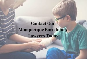 Contact Albuquerque Burn Injury Lawyer